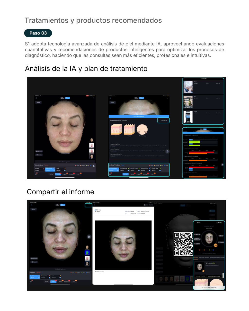 Escáner Facial SQNA S1