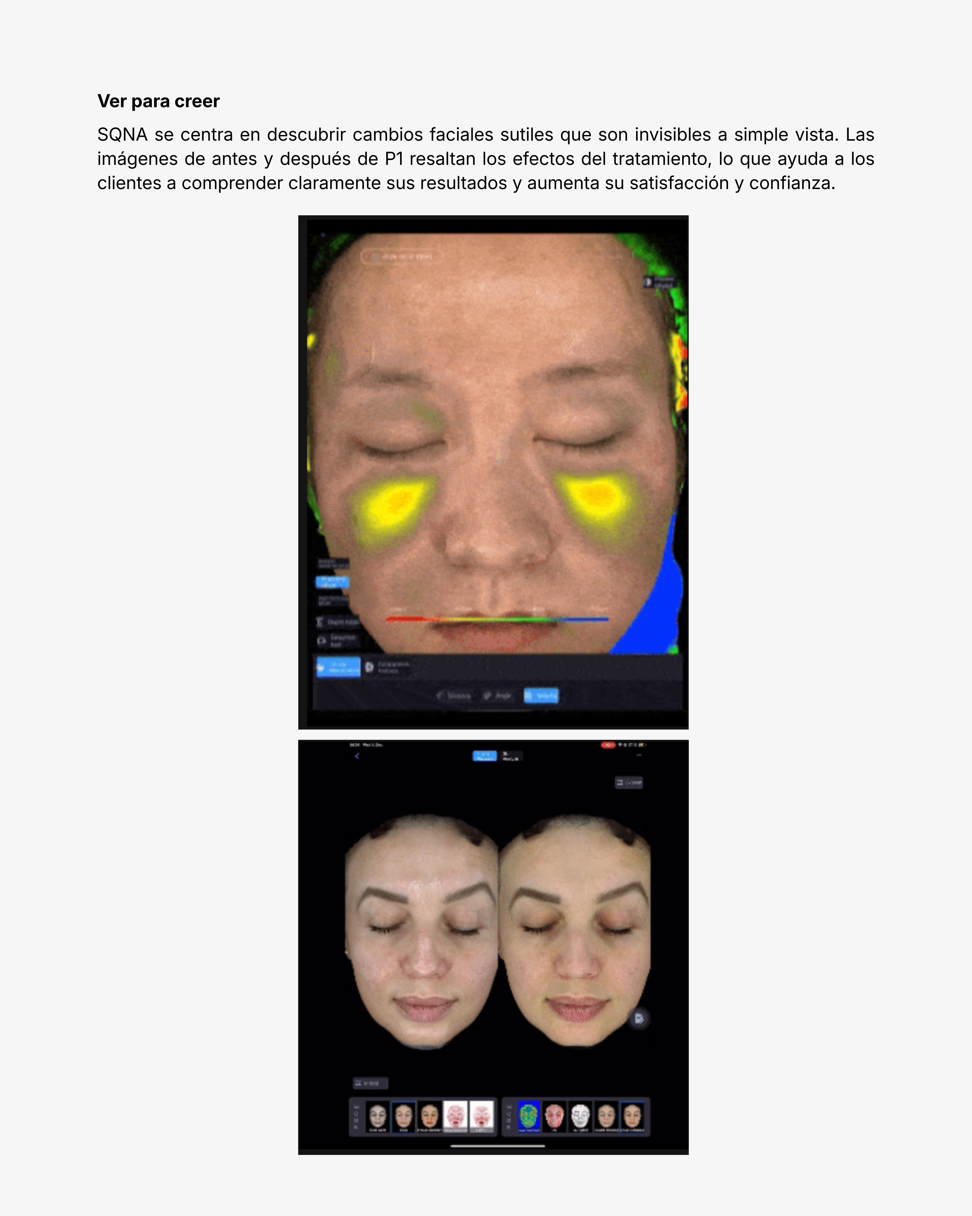 Escáner Facial SQNA P1