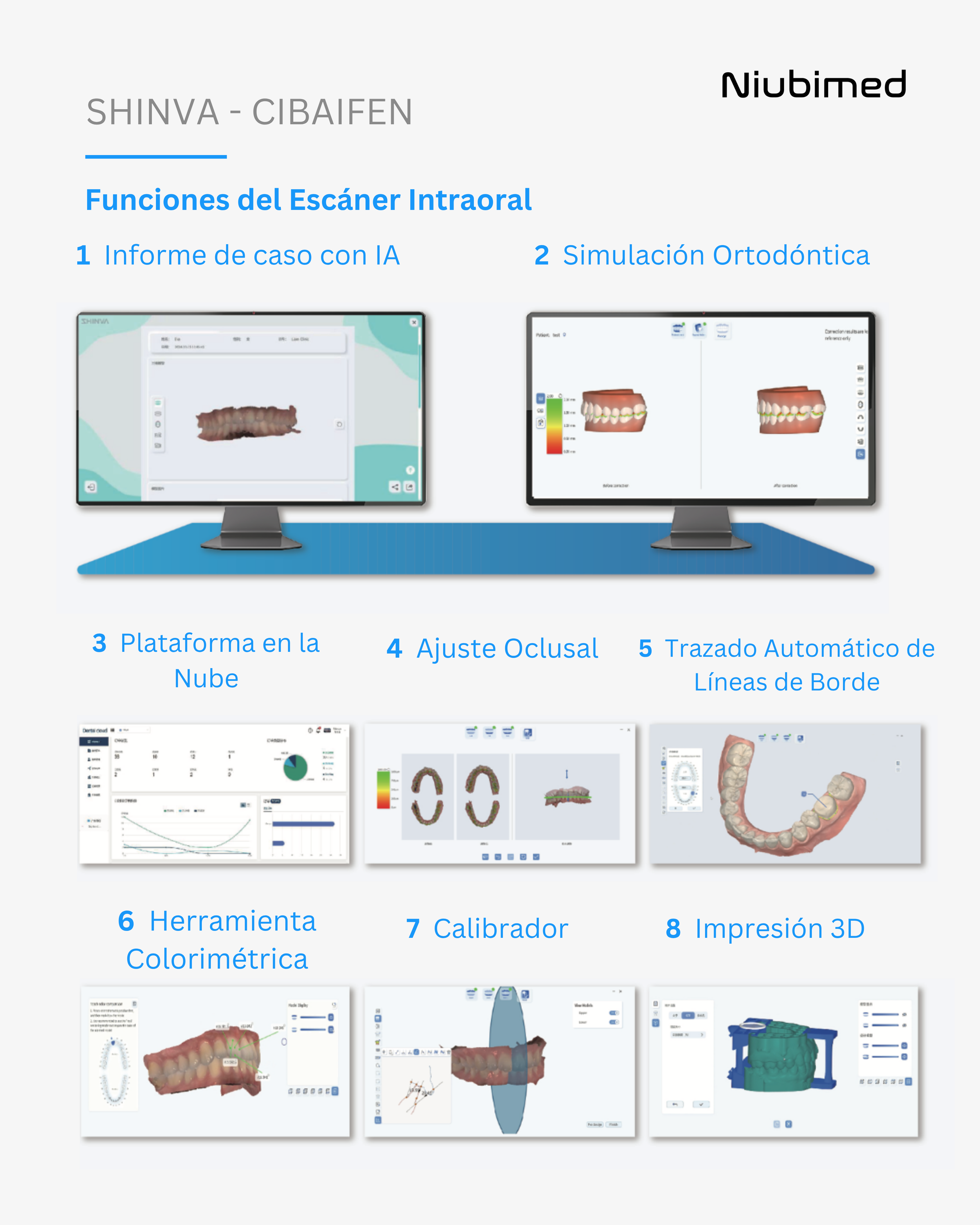 Escaner Intraoral - CIBAIFEN